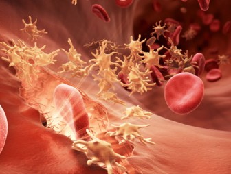 Гемофилия – наследственное заболевание