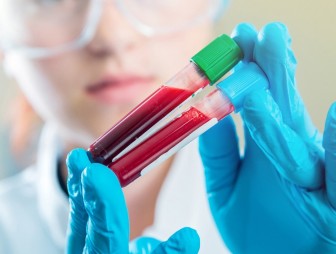 Анализ крови сможет предсказать смерть в ближайшие 10 лет