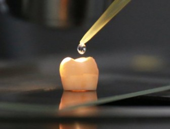 Изобретен способ, как восстановить зубную эмаль без пломб