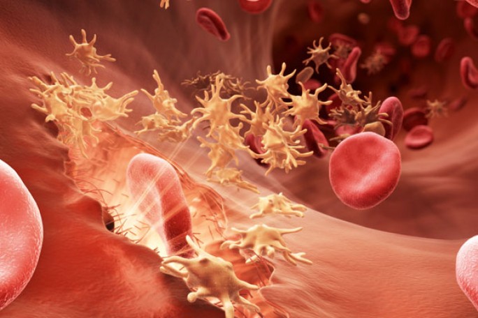 Гемофилия – наследственное заболевание
