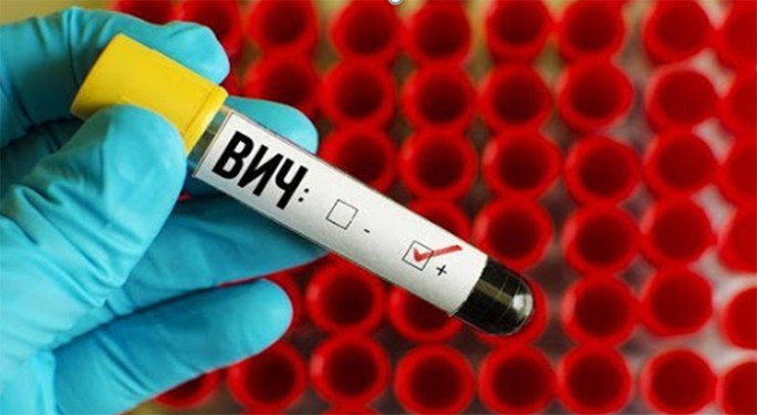 Как пройти обследование на ВИЧ, мостовчанам рассказывает врач-инфекционист