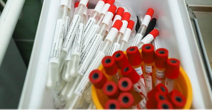 Белорусские вирусологи могут выявлять новый штамм коронавируса «омикрон»