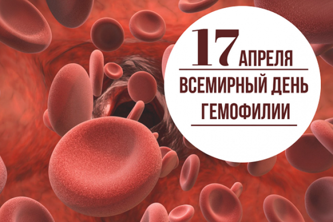 17 апреля – Всемирный день гемофилии. Что мы знаем об этой болезни?