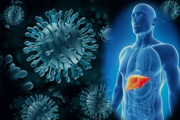 Болезнь Боткина: чем опасен вирус гепатита а и как от него защититься