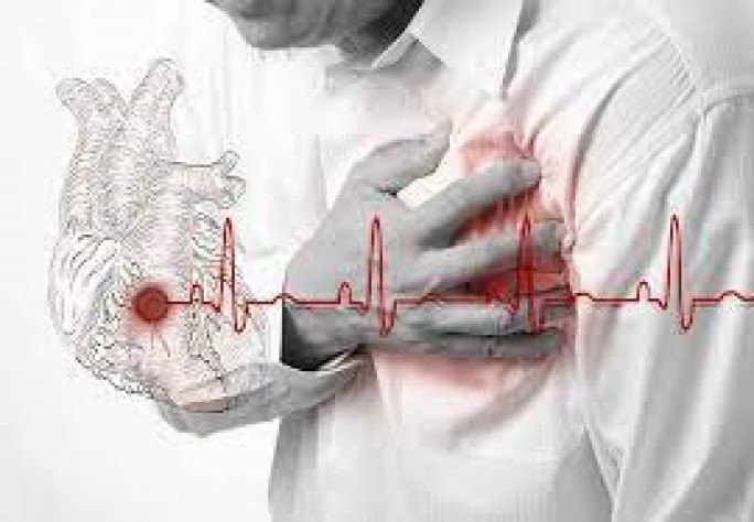 Что нужно знать об ишемической болезни сердца